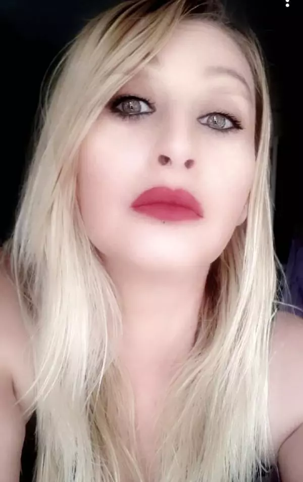 Estetik uğruna dudağını kaybeden Songül, doğal görünümüne kavuşacak