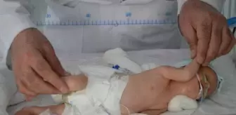Kilosu kadar tümörle dünyaya gelen bebeğe ameliyat