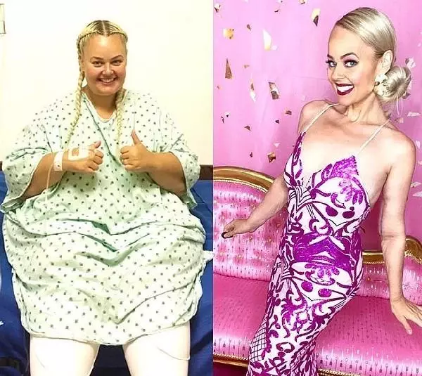 Sosyal medya fenomeni, barbie bebeğe benzemek için 90 kilo verdi Sosyal medya fenomeni, barbie bebeğe benzemek için 90 kilo verdi