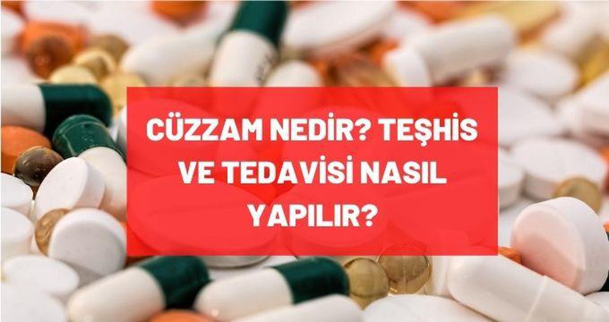 Cüzzam nedir? Cüzzam teşhiş ve tedavisi nasıl yapılır? Belirtileri nedir? Kimler risk altındadır?