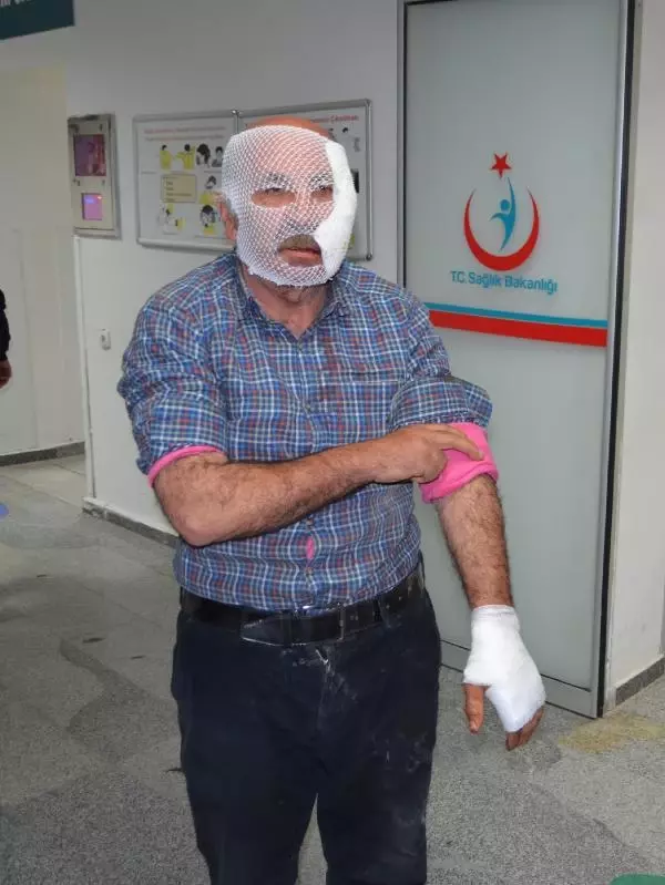 Son dakika haberleri Çocuklarını köpek saldırısından kurtardı, kendi