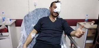 Otomobile kaya parçası düşmesiyle yaralanan muhtar: Birden camı kırarak içeri girdi