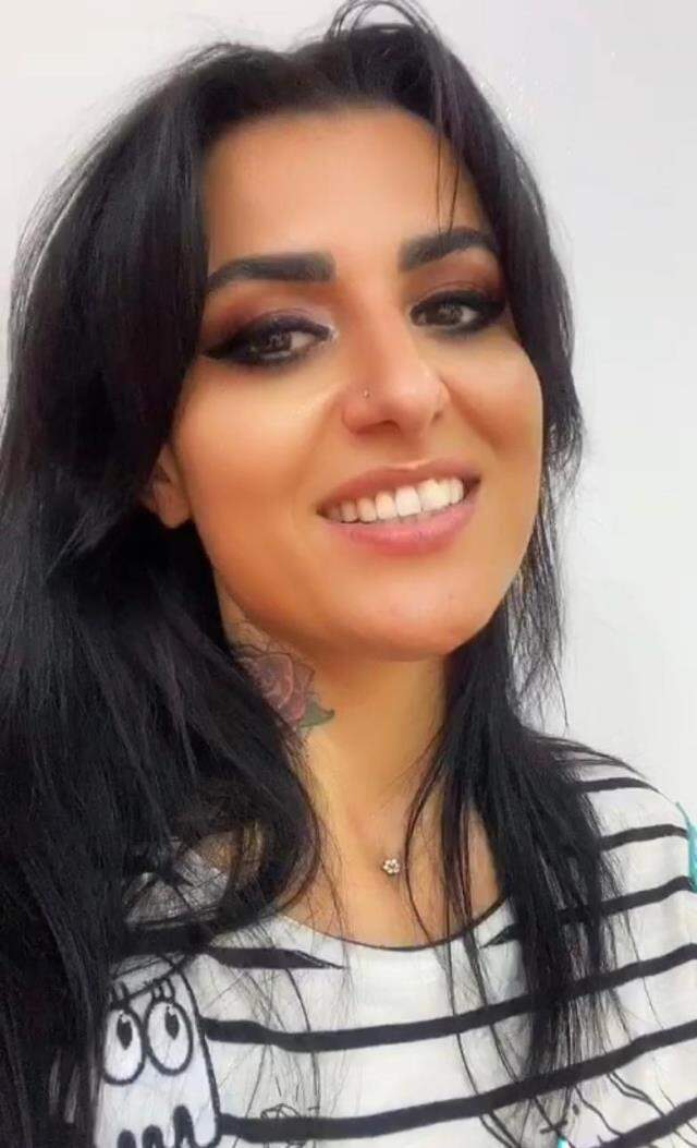 İnternetten önüne çıkan güzellik salonu ilanı kadının yüzünü yaktı, şimdi aylarca tedavi olmak zorunda