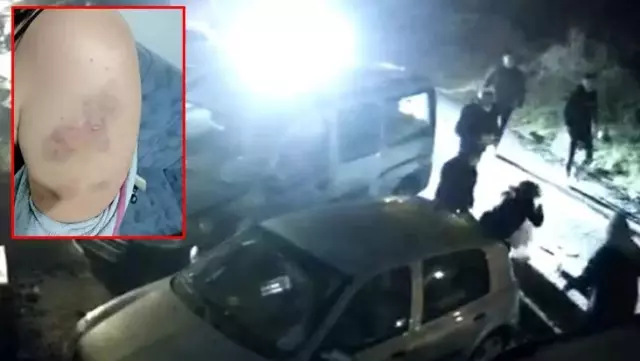 Kirayı geciktiren kadın, ev sahibi ve 6 kişi tarafından bayılana kadar dövüldü Kirayı geciktiren kadın, ev sahibi ve 6 kişi tarafından bayılana kadar dövüldü