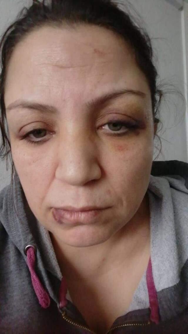 Kirayı geciktiren kadın, ev sahibi ve 6 kişi tarafından bayılana kadar dövüldü Kirayı geciktiren kadın, ev sahibi ve 6 kişi tarafından bayılana kadar dövüldü