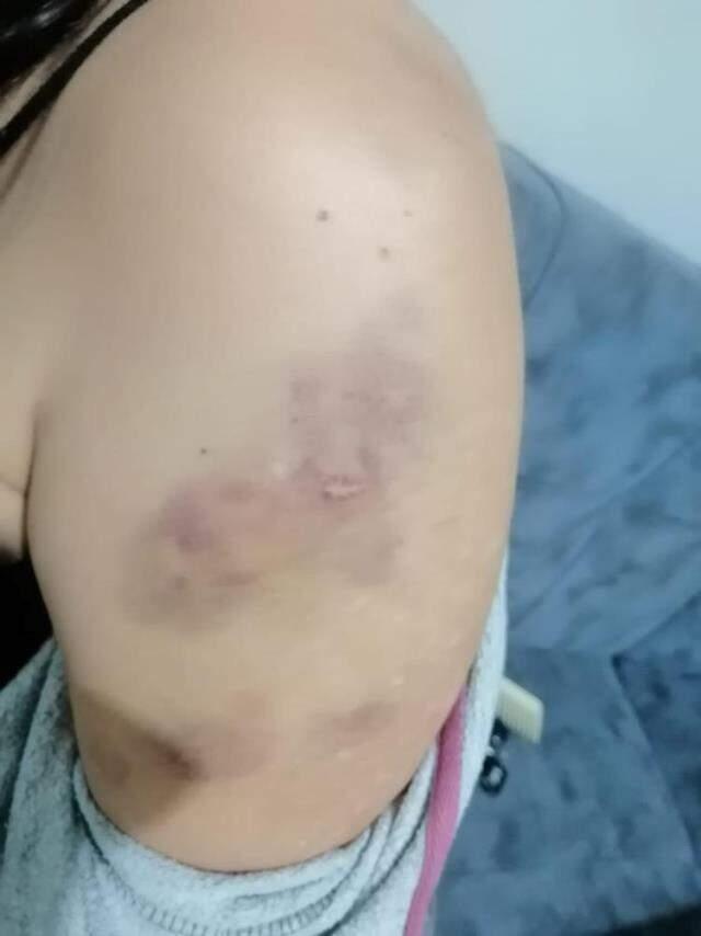 Kirayı geciktiren kadın, ev sahibi ve 6 kişi tarafından bayılana kadar dövüldü Kirayı geciktiren kadın, ev sahibi ve 6 kişi tarafından bayılana kadar dövüldü