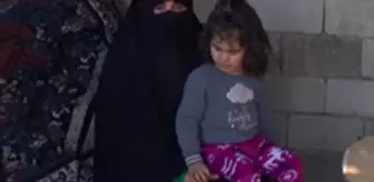 Belden aşağısı tandırda yanan Fatmanur, ayakkabı giyip, koşmak istiyor
