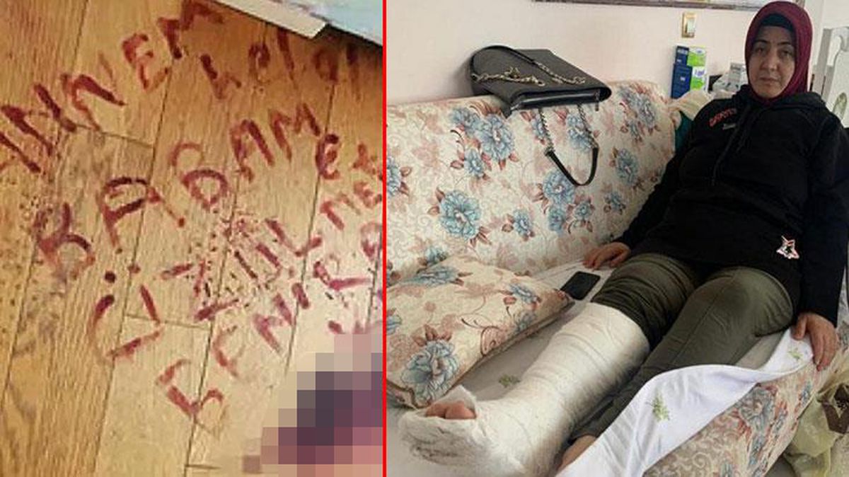 Kanıyla yere kendisini kimin vurduğunu yazan kadının kocasından pes dedirten sözler: İsteyerek olmadı