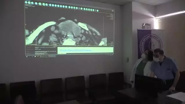 ZONGULDAK - 3,5 saatlik operasyonla boynundaki kitle alınan guatr hastası oksijen tüpünden kurtuldu ZONGULDAK - 3,5 saatlik operasyonla boynundaki kitle alınan guatr hastası oksijen tüpünden kurtuldu