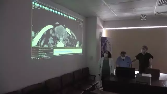 ZONGULDAK - 3,5 saatlik operasyonla boynundaki kitle alınan guatr hastası oksijen tüpünden kurtuldu ZONGULDAK - 3,5 saatlik operasyonla boynundaki kitle alınan guatr hastası oksijen tüpünden kurtuldu