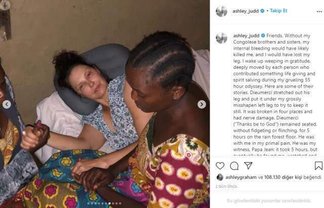 Issız ormanda bacağını kıran oyuncu Ashley Judd, 55 saatte hastaneye ulaştı Issız ormanda bacağını kıran oyuncu Ashley Judd, 55 saatte hastaneye ulaştı
