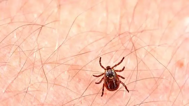 Örümcek Isırığı Nasıl Olur ve Nasıl Anlaşılır? Örümcek Isırığı Nasıl Geçer ve Ne İyi Gelir Örümcek Isırığı Nasıl Olur ve Nasıl Anlaşılır? Örümcek Isırığı Nasıl Geçer ve Ne İyi Gelir