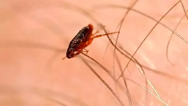 Pire Isırığı Nasıl Olur ve Nasıl Anlaşılır? Pire Isırığı Nasıl Geçer ve Ne İyi Gelir Pire Isırığı Nasıl Olur ve Nasıl Anlaşılır? Pire Isırığı Nasıl Geçer ve Ne İyi Gelir