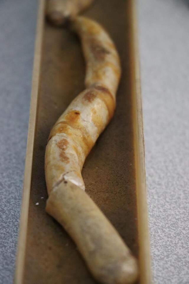 Hataylı doktordan hayrete düşüren koleksiyon; kimisi 22 santim, kimisi 650 gram Hataylı doktordan hayrete düşüren koleksiyon; kimisi 22 santim, kimisi 650 gram