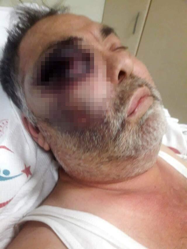 Vicdansızlar, yüzde 90 engelli vatandaşı öldüresiye dövdü Vicdansızlar, yüzde 90 engelli vatandaşı öldüresiye dövdü