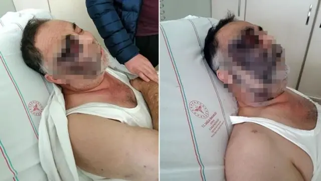 Vicdansızlar, yüzde 90 engelli vatandaşı öldüresiye dövdü Vicdansızlar, yüzde 90 engelli vatandaşı öldüresiye dövdü