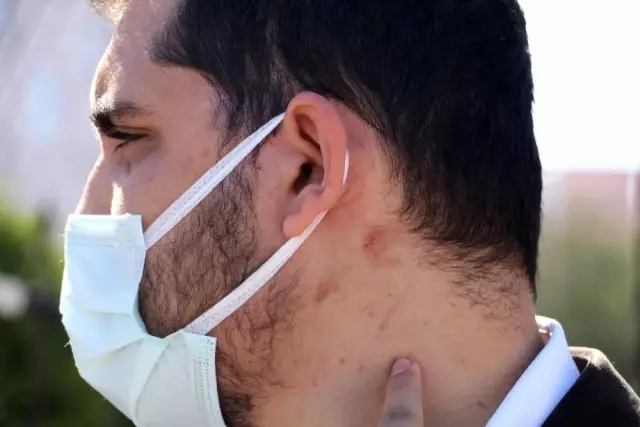 Vicdansızlar, yüzde 90 engelli vatandaşı öldüresiye dövdü Vicdansızlar, yüzde 90 engelli vatandaşı öldüresiye dövdü
