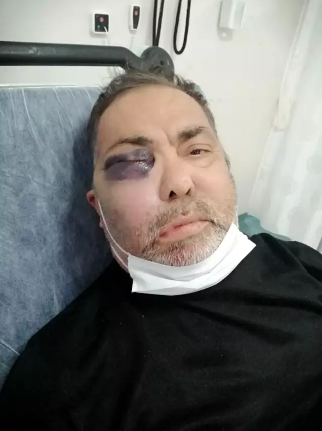 Vicdansızlar, yüzde 90 engelli vatandaşı öldüresiye dövdü Vicdansızlar, yüzde 90 engelli vatandaşı öldüresiye dövdü