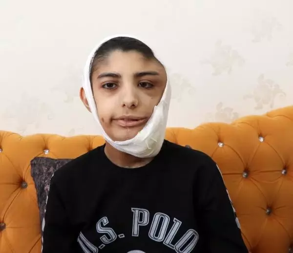 Yüzünde çıkan tümör sonrası kapanmayan yara her gün büyüyor Yüzünde çıkan tümör sonrası kapanmayan yara her gün büyüyor
