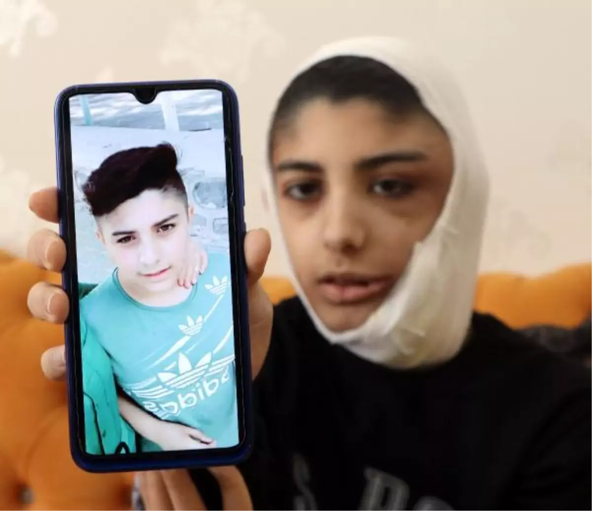 Yüzünde çıkan tümör sonrası kapanmayan yara her gün büyüyor