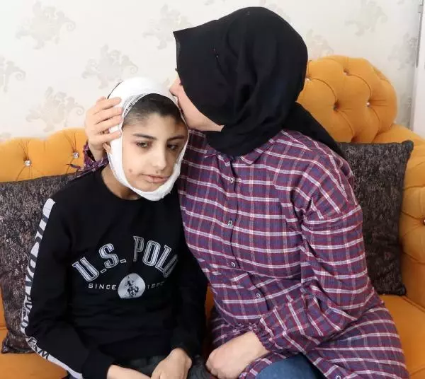 Yüzünde çıkan tümör sonrası kapanmayan yara her gün büyüyor Yüzünde çıkan tümör sonrası kapanmayan yara her gün büyüyor