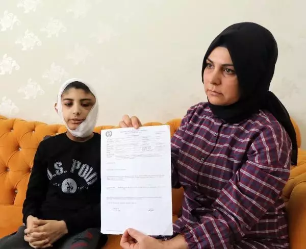 Yüzünde çıkan tümör sonrası kapanmayan yara her gün büyüyor Yüzünde çıkan tümör sonrası kapanmayan yara her gün büyüyor