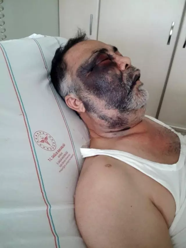 Son Dakika | Darp iddiasıyla hastanelik olan yüzde 90 engelli vatandaş olayında flaş gelişme Son Dakika | Darp iddiasıyla hastanelik olan yüzde 90 engelli vatandaş olayında flaş gelişme