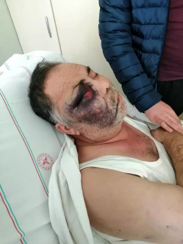 Son Dakika | Darp iddiasıyla hastanelik olan yüzde 90 engelli vatandaş olayında flaş gelişme Son Dakika | Darp iddiasıyla hastanelik olan yüzde 90 engelli vatandaş olayında flaş gelişme