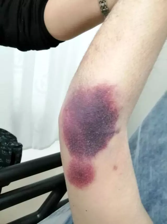 Son Dakika | Darp iddiasıyla hastanelik olan yüzde 90 engelli vatandaş olayında flaş gelişme Son Dakika | Darp iddiasıyla hastanelik olan yüzde 90 engelli vatandaş olayında flaş gelişme