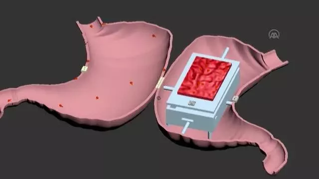 Siirt Üniversitesi öğretim üyelerinin geliştirdiği akıllı maket eğitim setine 'incelemeli patent' verildi Siirt Üniversitesi öğretim üyelerinin geliştirdiği akıllı maket eğitim setine 'incelemeli patent' verildi