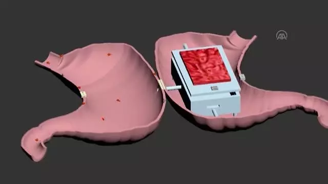 Siirt Üniversitesi öğretim üyelerinin geliştirdiği akıllı maket eğitim setine 'incelemeli patent' verildi Siirt Üniversitesi öğretim üyelerinin geliştirdiği akıllı maket eğitim setine 'incelemeli patent' verildi