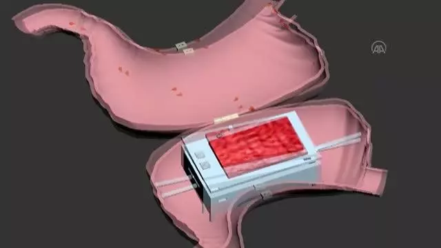 Siirt Üniversitesi öğretim üyelerinin geliştirdiği akıllı maket eğitim setine 'incelemeli patent' verildi Siirt Üniversitesi öğretim üyelerinin geliştirdiği akıllı maket eğitim setine 'incelemeli patent' verildi