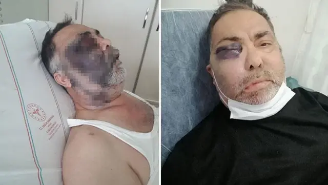 Engelli adamın darp sonrası ölümüne ikinci tutuklama Engelli adamın darp sonrası ölümüne ikinci tutuklama