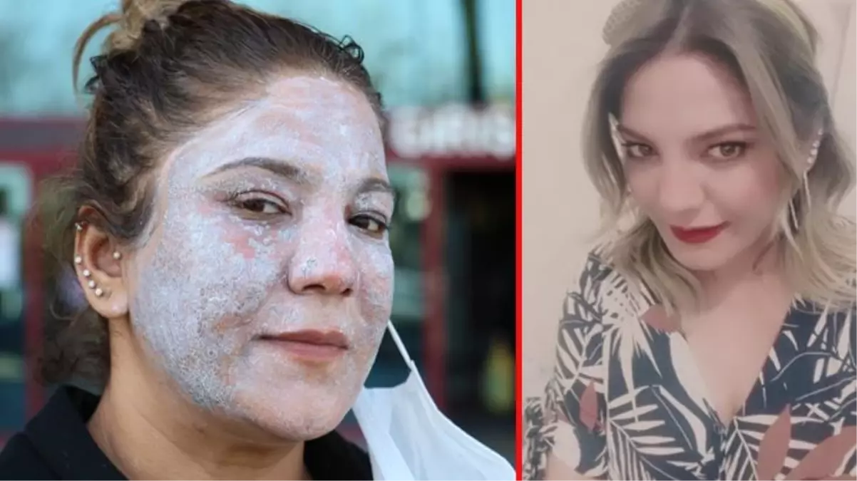 &quot;Cildin bebek gibi olacak&quot; denilerek yattığı masadan