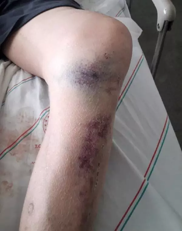 'Evde iyileştiririm dediğim kocamı, ellerimle toprağa verdim' 'Evde iyileştiririm dediğim kocamı, ellerimle toprağa verdim'