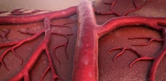Aort damarı genişlemesi nedir? Damar (Aort)genişlemesi neden olur, nedenleri ve belirtileri nelerdir? Tedavisi nasıl yapılır?