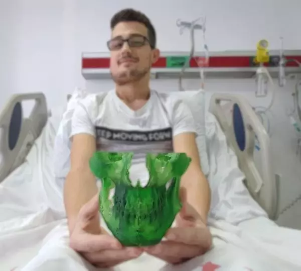 Yüzündeki dev tümörden 'sanal ameliyat' ile kurtuldu Yüzündeki dev tümörden 'sanal ameliyat' ile kurtuldu