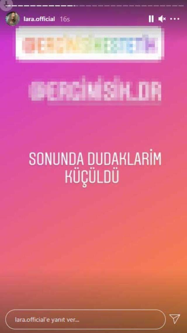 Ameliyat masasına yatan ünlü şarkıcı Lara, dudaklarını küçülttü Ameliyat masasına yatan ünlü şarkıcı Lara, dudaklarını küçülttü