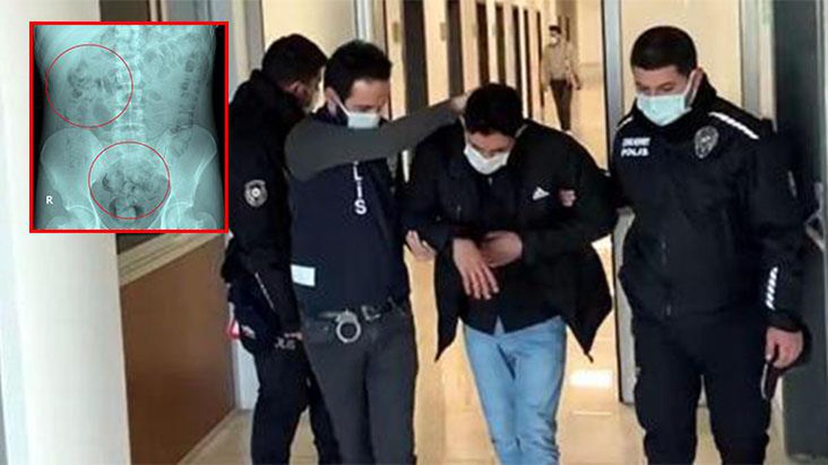 İranlı uyuşturucu şüphelisinin midesinden 890 gram uyuşturucu çıktı