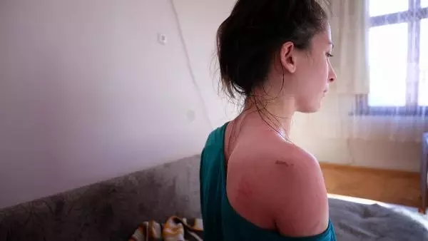 Eşini ve kızını kaynar suyla haşlayan kocanın 'kazara oldu' savunmasına hakimden tepki Eşini ve kızını kaynar suyla haşlayan kocanın 'kazara oldu' savunmasına hakimden tepki