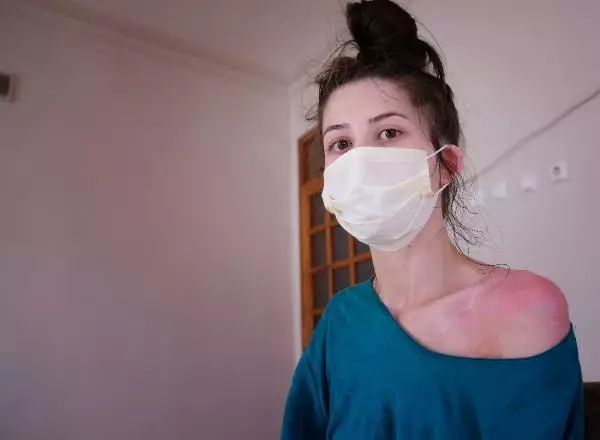 Eşini ve kızını kaynar suyla haşlayan kocanın 'kazara oldu' savunmasına hakimden tepki Eşini ve kızını kaynar suyla haşlayan kocanın 'kazara oldu' savunmasına hakimden tepki