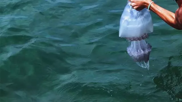 Zehirli denizanasının soktuğu 17 yaşındaki genç yaşam mücadelesini kaybetti Zehirli denizanasının soktuğu 17 yaşındaki genç yaşam mücadelesini kaybetti