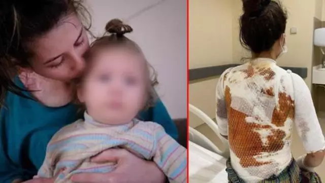 Eşini ve kızını kaynar suyla haşlayan kocanın 'kazara oldu' savunmasına hakimden tepki Eşini ve kızını kaynar suyla haşlayan kocanın 'kazara oldu' savunmasına hakimden tepki
