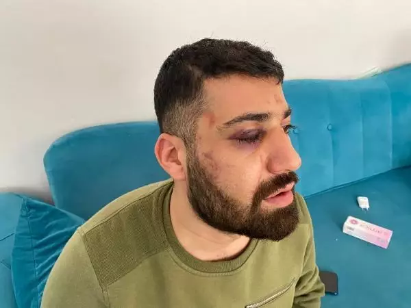 'Polis defalarca başıma vurdu' dedi, nezarethanedeki akıl almaz görüntüleri ortaya çıktı 'Polis defalarca başıma vurdu' dedi, nezarethanedeki akıl almaz görüntüleri ortaya çıktı