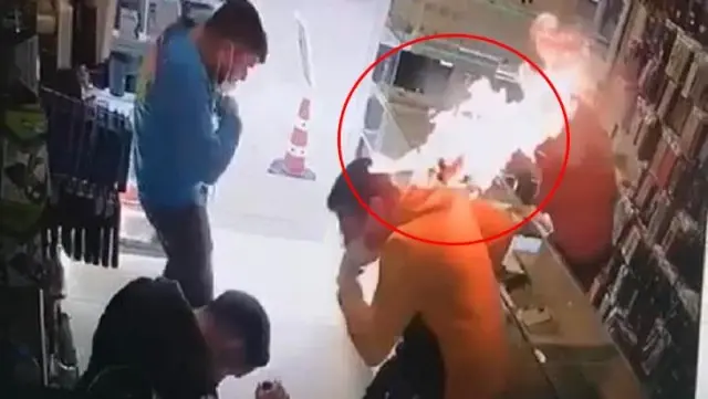 Cep telefonunun bataryası patlayan adam alevlerin arasında kaldı Cep telefonunun bataryası patlayan adam alevlerin arasında kaldı