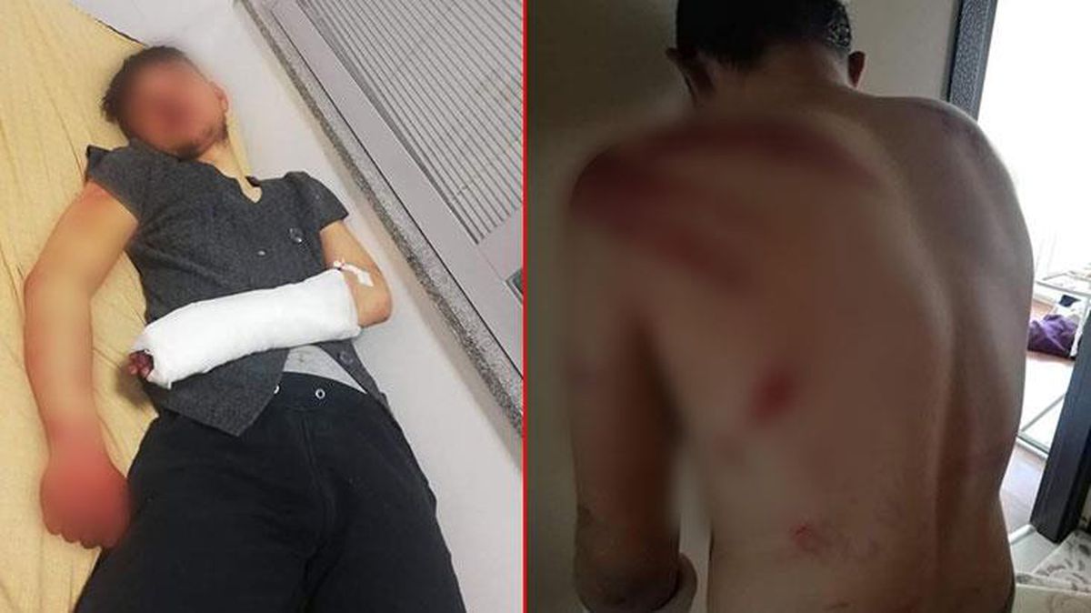 16 yaşındaki genci, 5 saat boyunca dinlene dinlene döven şüpheliler yakalandı