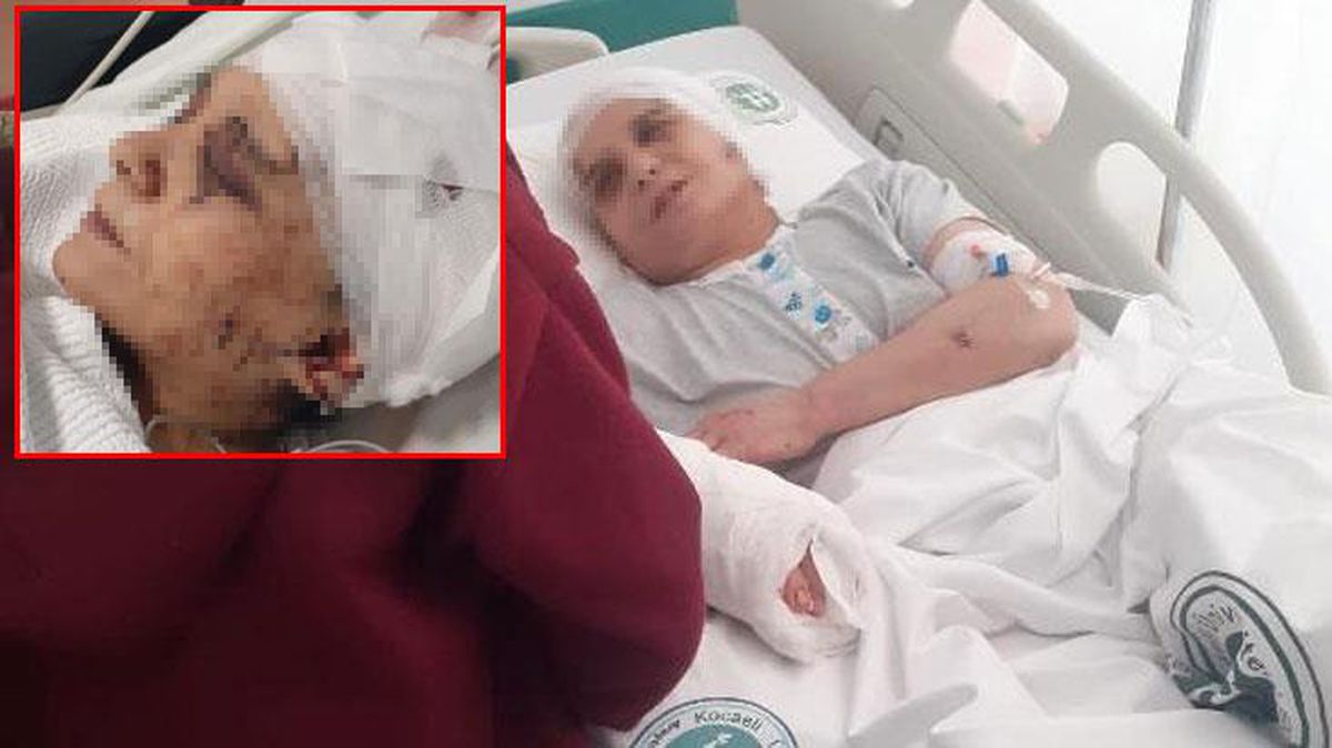 Çalışmasını istemediği eşine satırla saldırdı! Kulağını, kafasını ve parmağını kesti