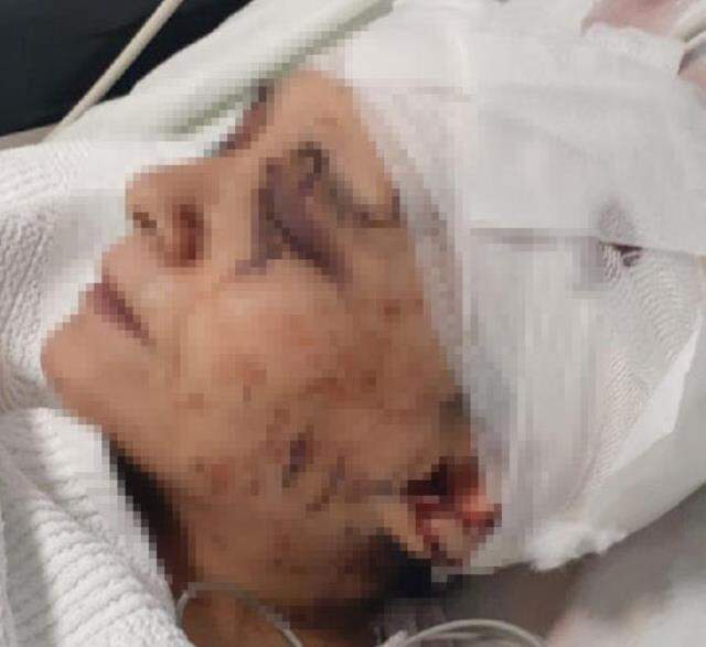 Çalışmasını istemediği eşini 10 satır darbesiyle yaraladı