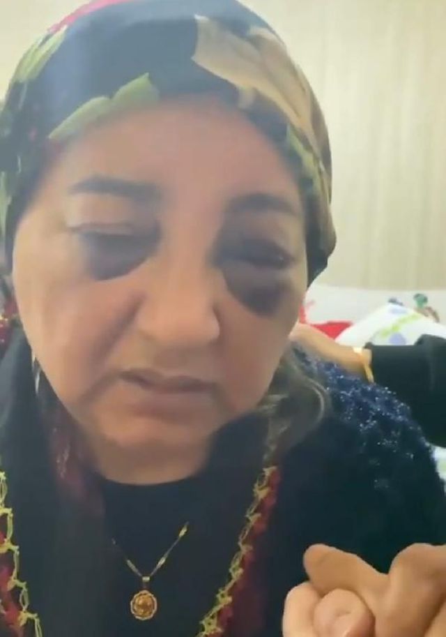 esini gozleri morarincaya kadar dovup ac bira 3 13982205 o