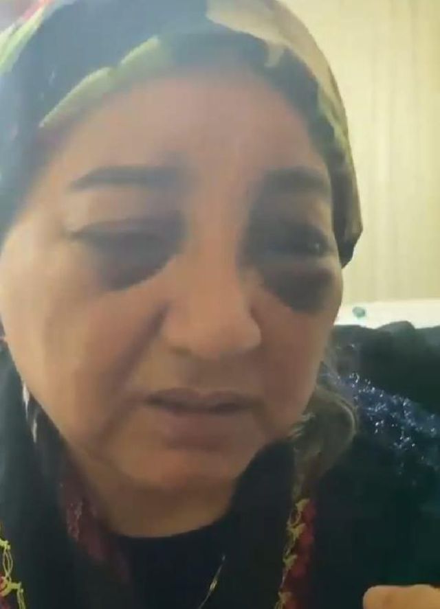 esini gozleri morarincaya kadar dovup ac bira 4 13982205 o